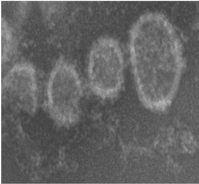 Tomato Spotted Wilt Virus, photographed on the affected plant