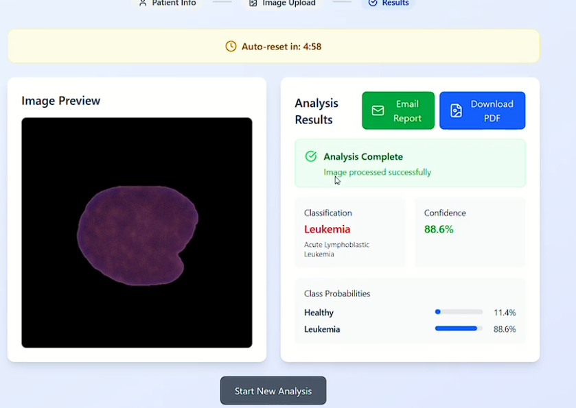 Leukemia Detector