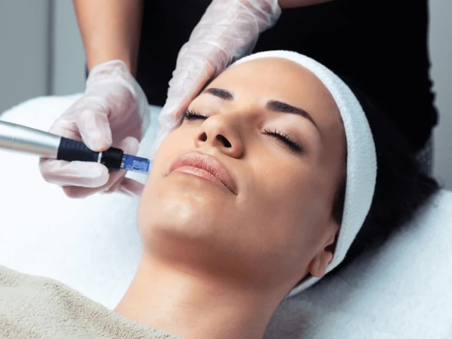 MICRONEEDLING services at Call of Beauty Med Spa in Encinitas