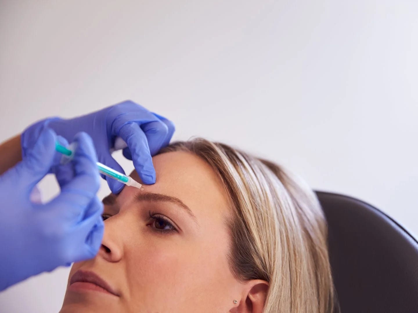 Botox Injections treatment at Call of Beauty Med Spa in Encinitas, CA