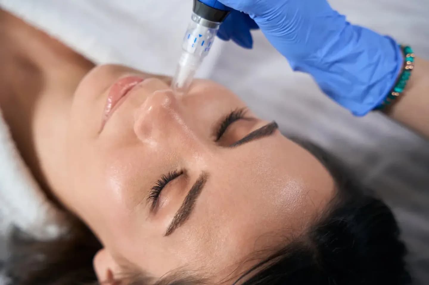 Microneedling with Serums Encinitas | Hydrate & Glow