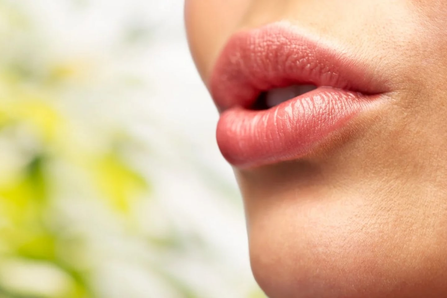 Filler Dissolve Treatment (Hyaluronidase)