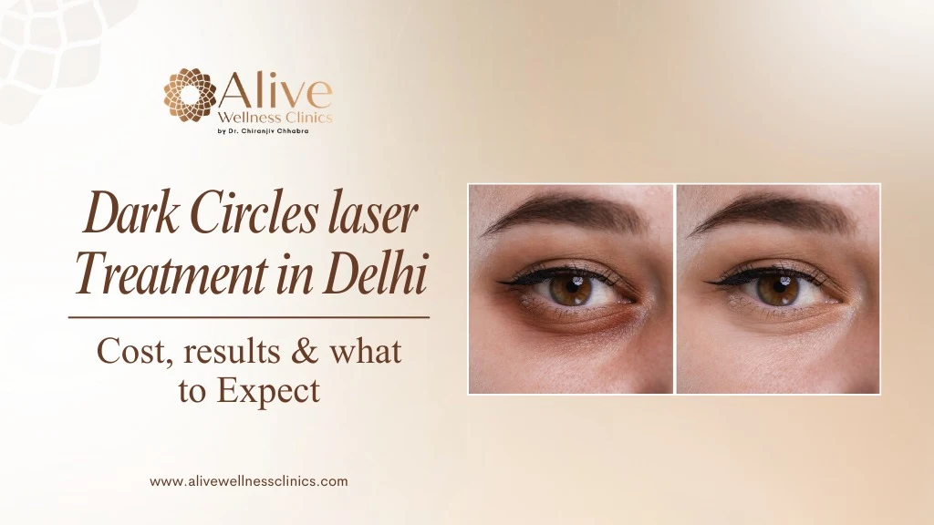 Dark Circle Laser Treatment in Delhi: Cost, Results & What to Expect