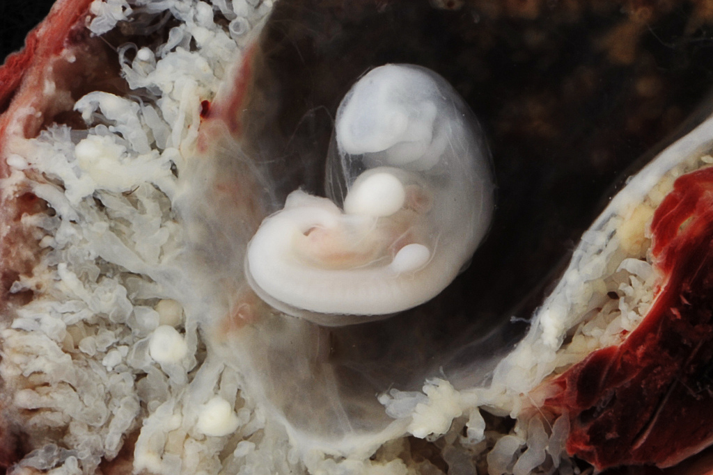 Эмбрион человека 6 недель фото