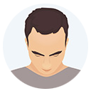 Hair Loss Grade or Level 1