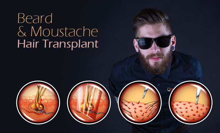 Trichos | Hair Restoration | Beard & Moustache Hair Trichos | Hair Restoration | Beard & Moustache Hair