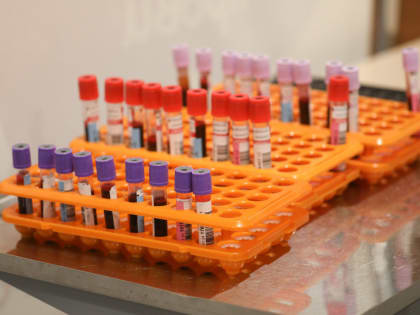 Бастрыкин потребовал проверить поставщиков оборудования для диабетиков в Петербурге