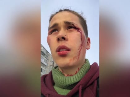 Уголовное дело могут завести по факту избиения блогера Шучера в автобусе в Петербурге