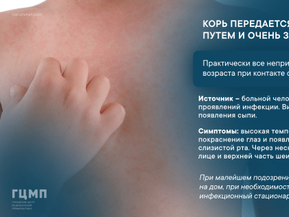 Внимание! Корь!