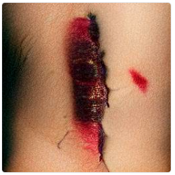 No contact is the ultimate solution. Wounds will heal.