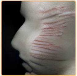 Narcissism means suffering