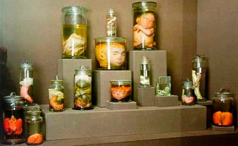 Кунсткамера