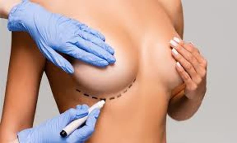Breast Augmentation procedure image