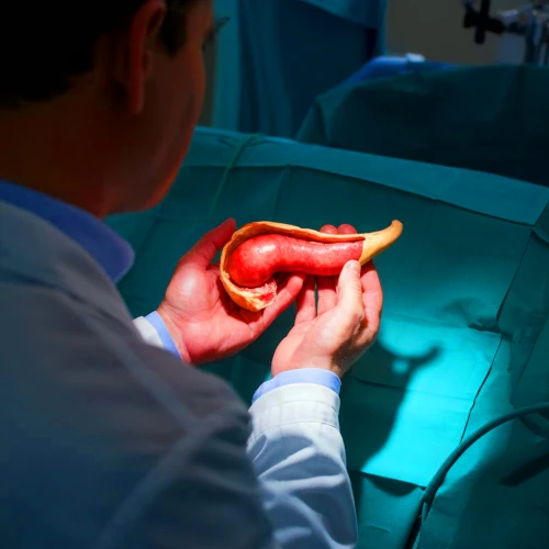 General Surgery and Laproscopy