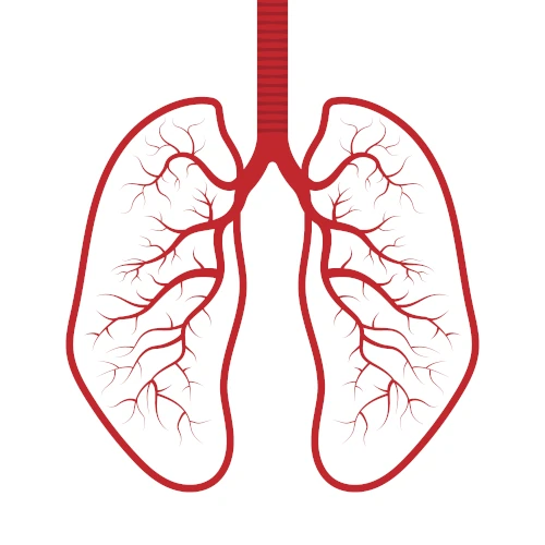 Esophagectomy