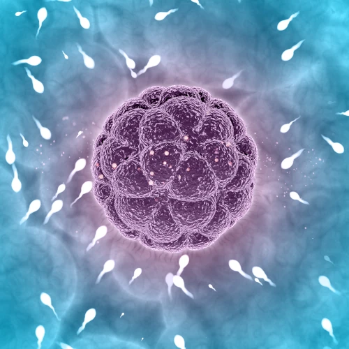 Intracytoplasmic Sperm Injection