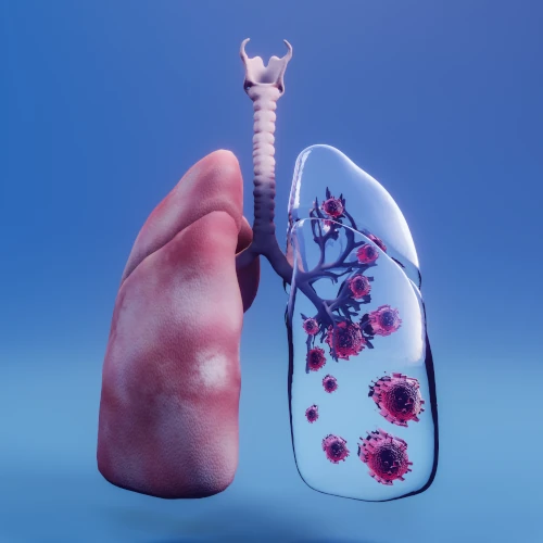 Lung Transplant