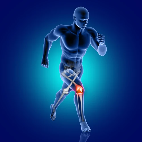 Total Knee Replacement
