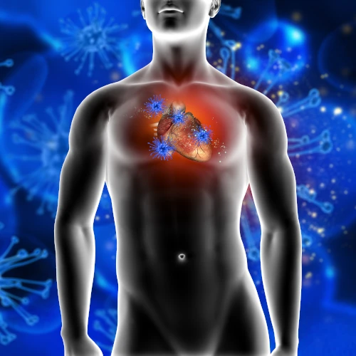 Aortic Aneurysm Repair