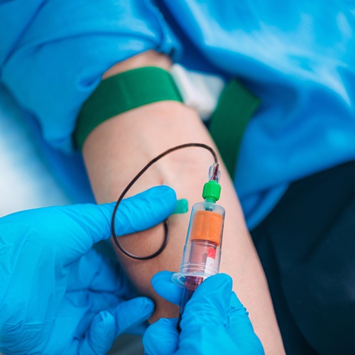 Hemophilia Treatment