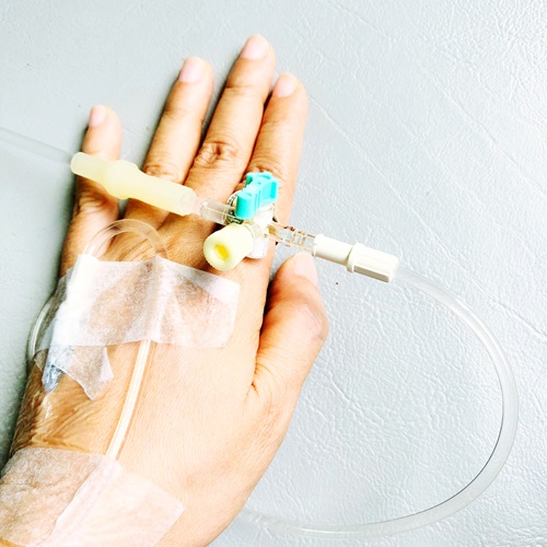 Enteral Nutrition