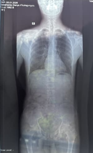 Front View X-Ray; January 2026
