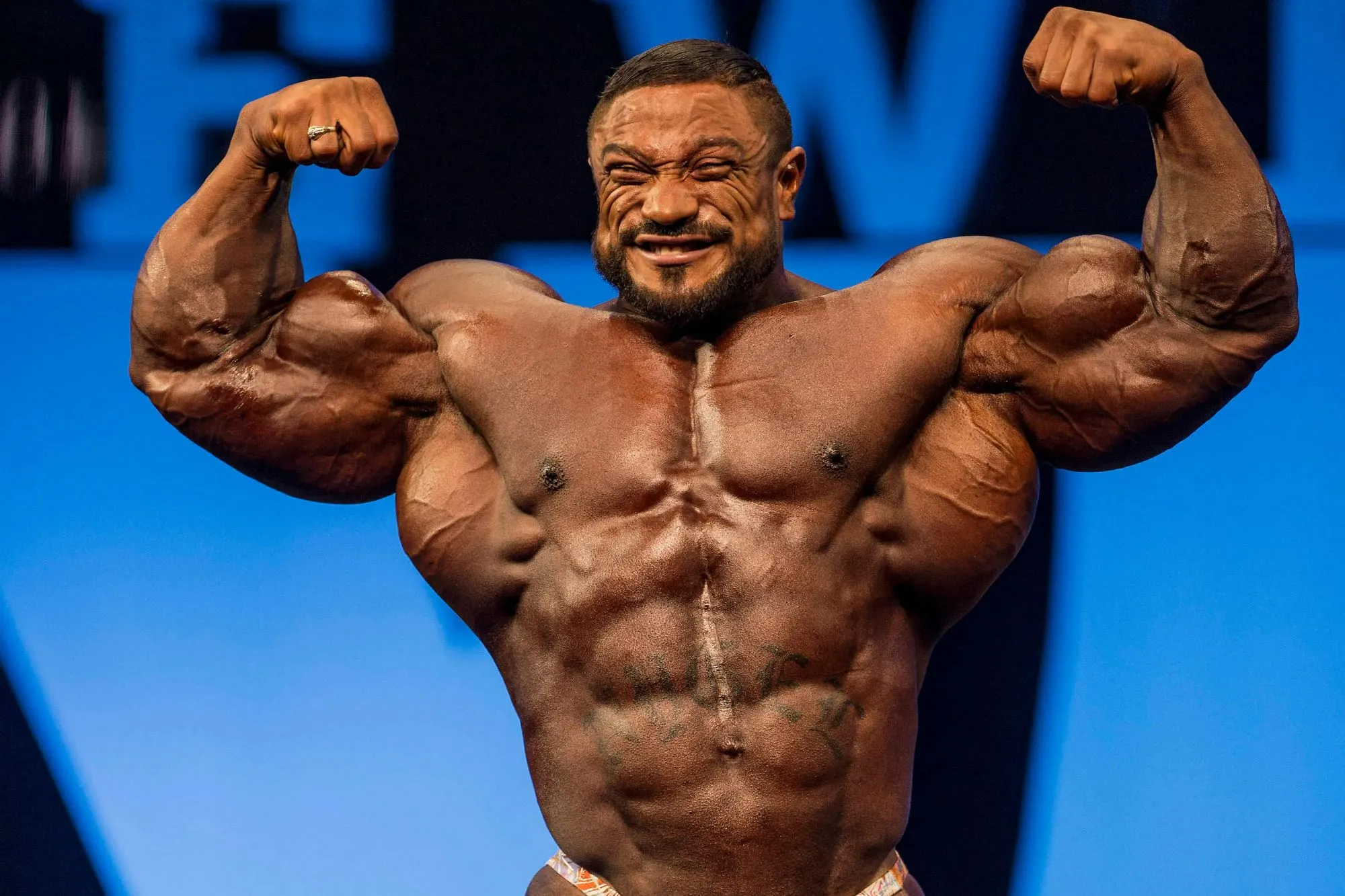 Roelly Winklaar - صورة 1