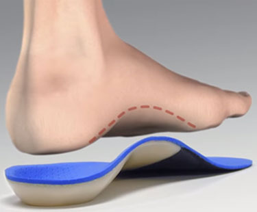 Custom Made Insoles - Gallery Image 1