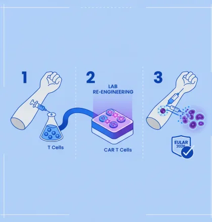 CAR T Cell Therapy Shows Efficacy in Autoimmune Diseases at EULAR 2026