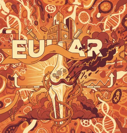 Lupus Management: Progress and Persistent Challenges at EULAR 2026