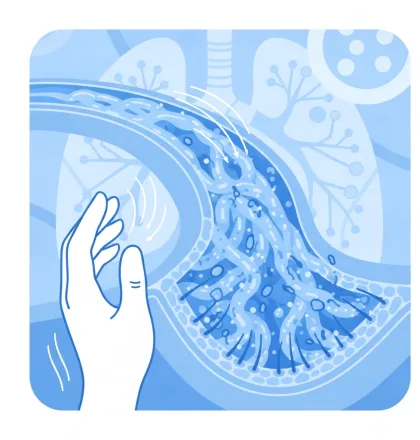 Airway mucus: Is it a symptom or the disease driver in lung conditions?