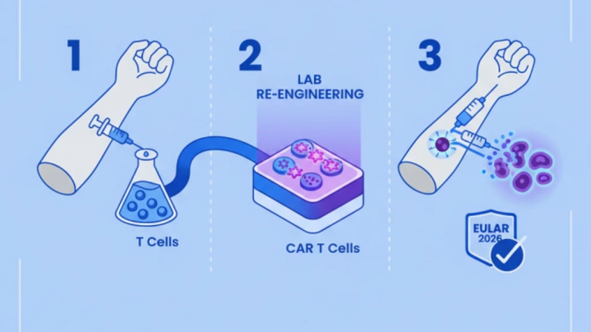 CAR T Cell Therapy Shows Efficacy in Autoimmune Diseases at EULAR 2026