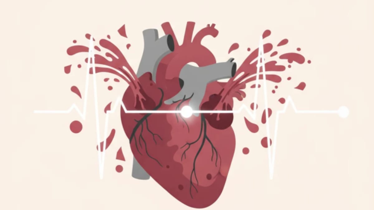 Mitral and Tricuspid Regurgitation: Timing Intervention in Heart Failure