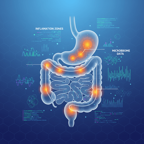 predicting-loss-of-response-in-crohn-s-disease-novel-endoluminal-parameters