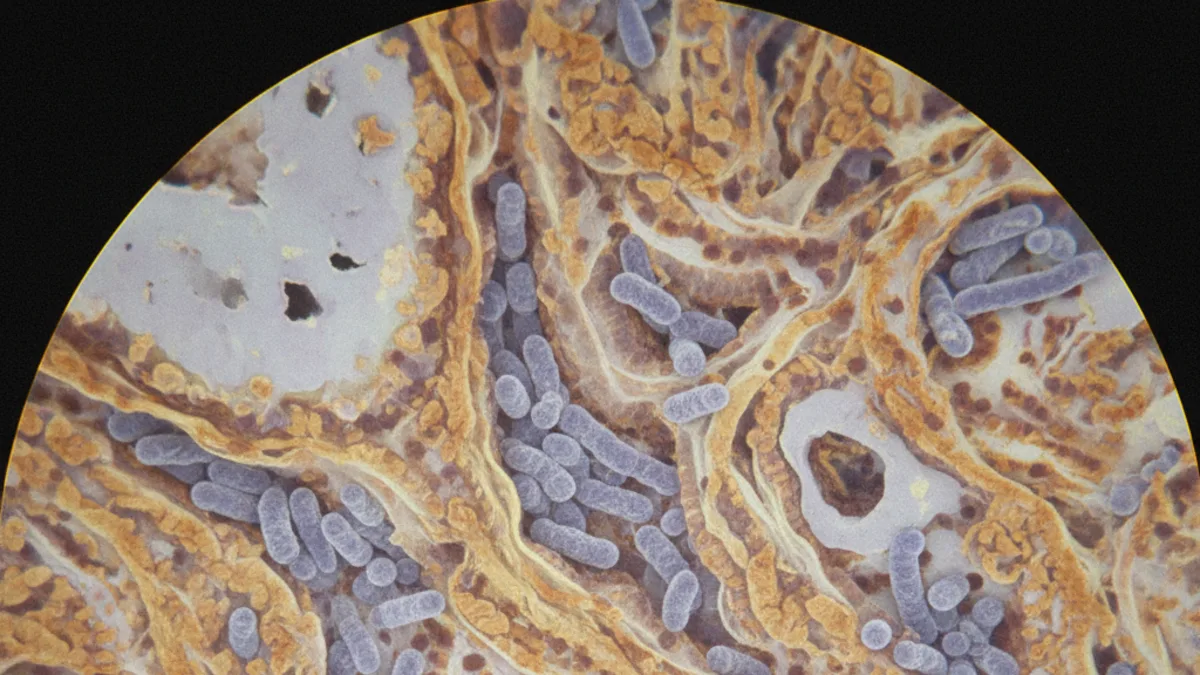 Systemic Sclerosis and Pulmonary Tuberculosis Risk