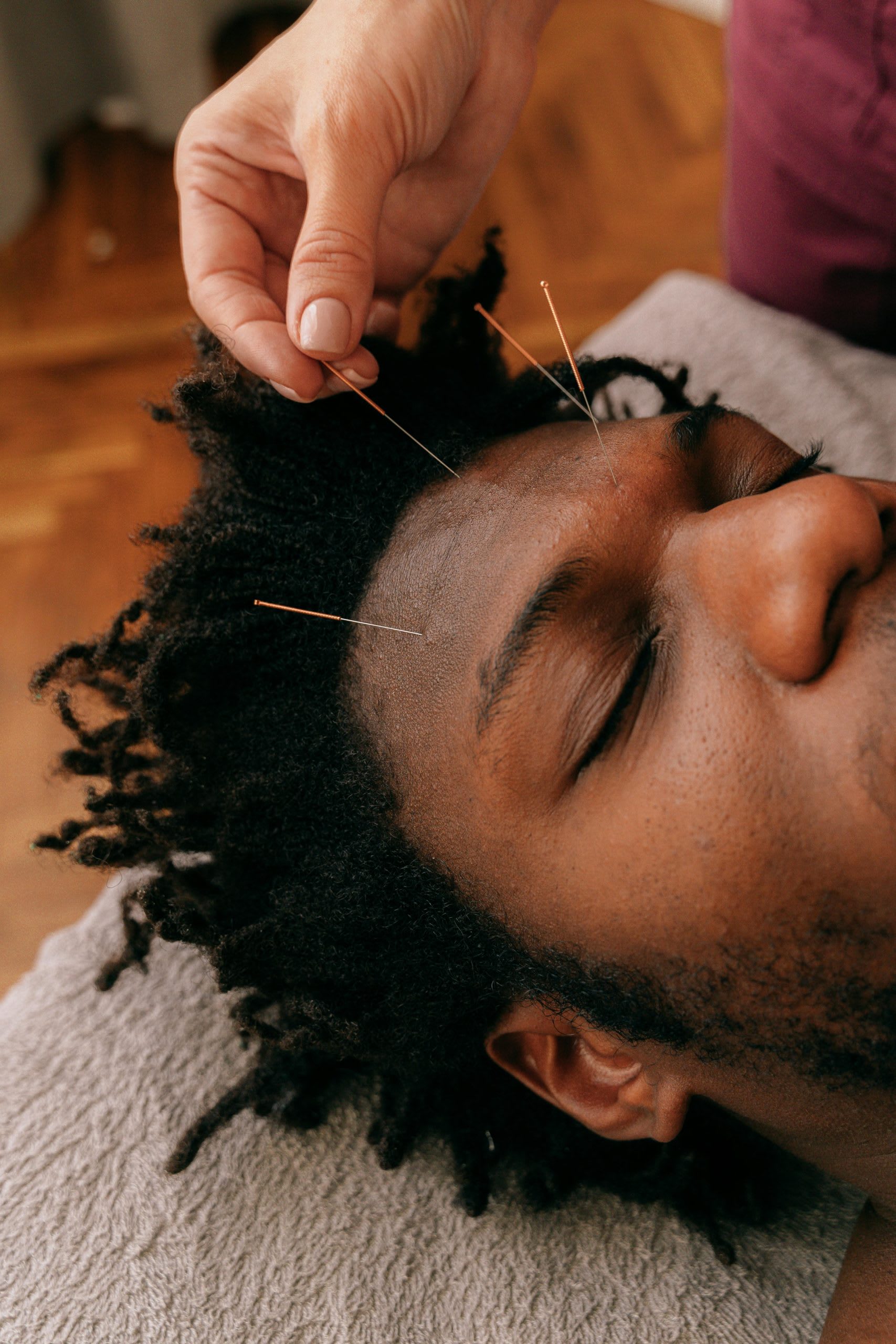5 Ways Acupuncture Benefits Mental Health