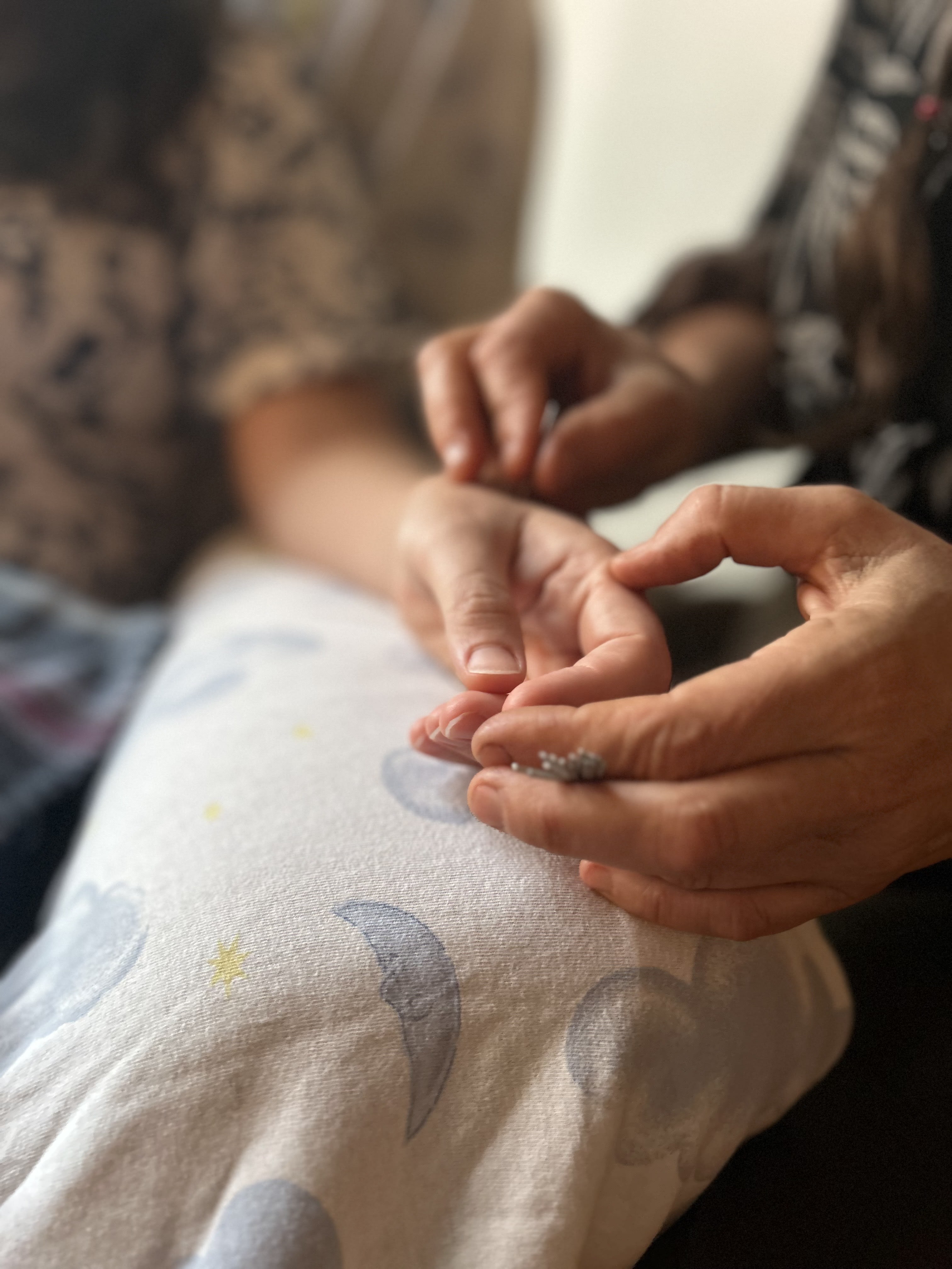 Ask the Acupuncturist: Why Do I Feel Some Needles More Than Others?
