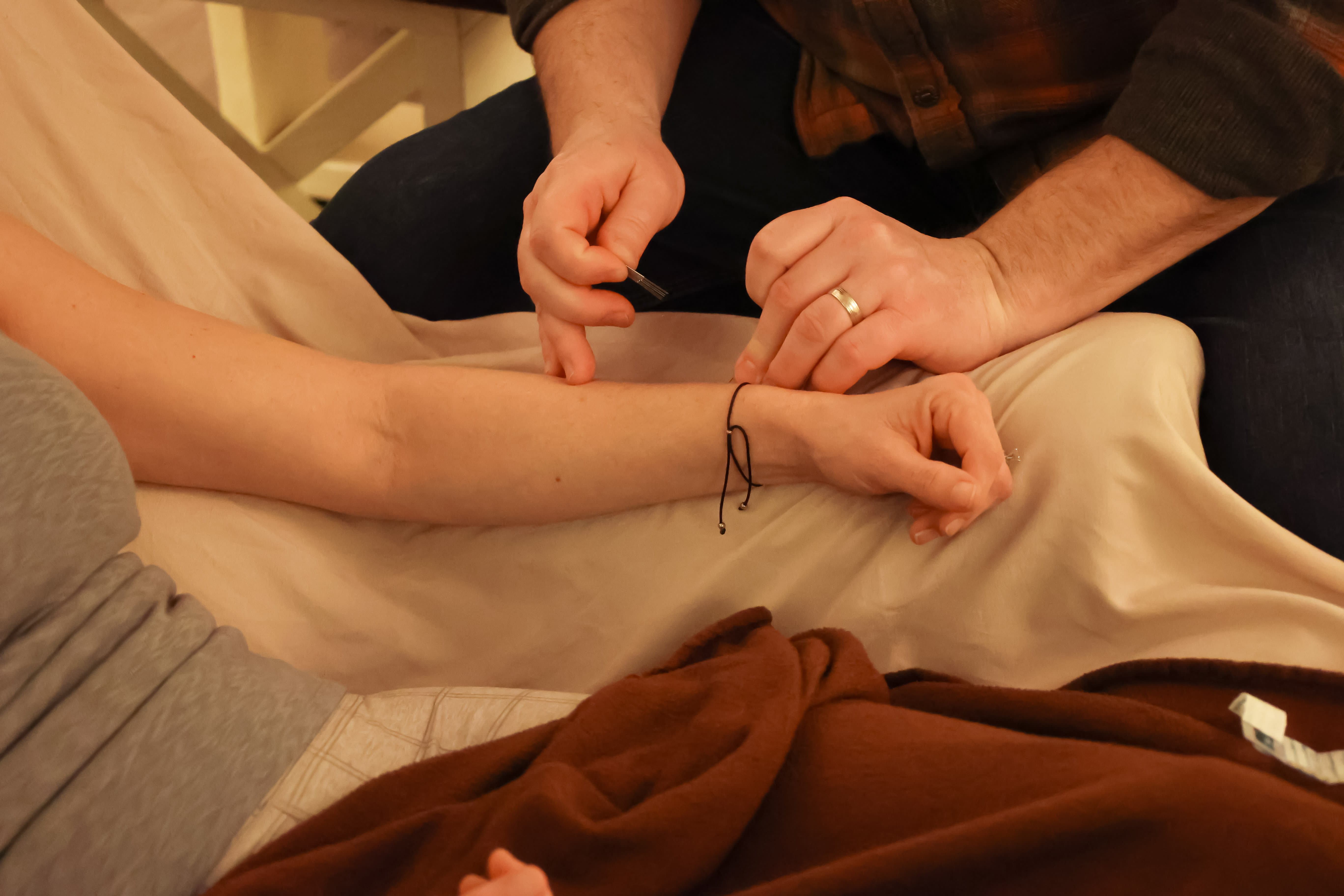 Exploring the Science of How Acupuncture Works