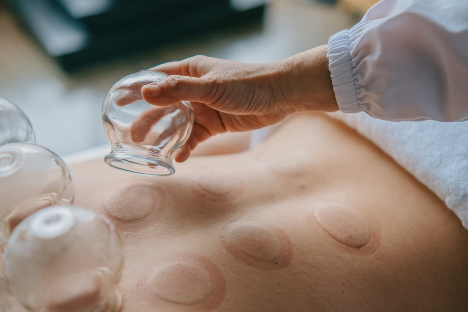 Cupping