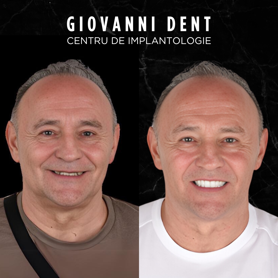 Imagine Giovanni