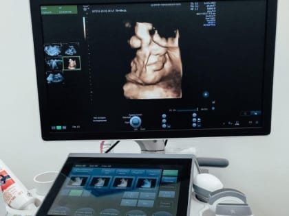 Увидеть 4D-изображение ребенка в утробе матери стало возможно в Пскове
