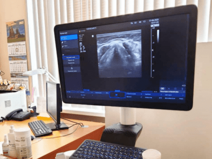 В подразделение №3 Псковской городской поликлиники поступил ультразвуковой сканер