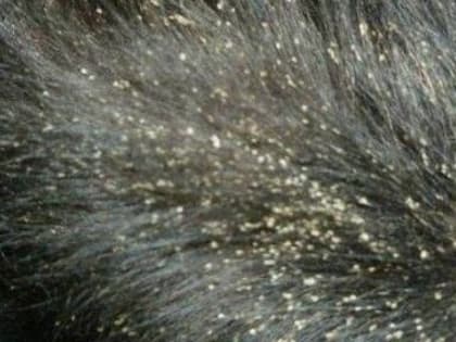 Белая перхоть у кошки. Клещ хейлетиелла перхоть. Кошачьи паразиты власоеды