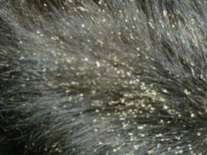 «Блуждающую перхоть» обнаружили в Псковской области