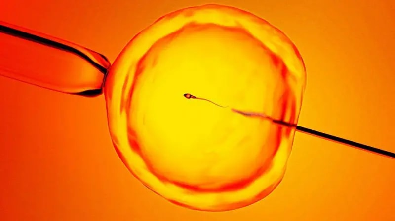 Imagen para: IA detecta espermatozoides ocultos: esperanza nueva para hombres infértiles