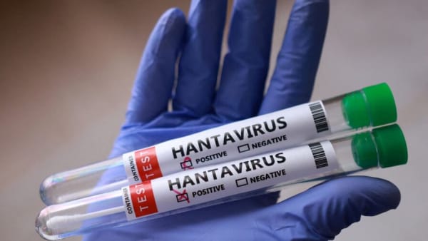 Imagen para: La OMS eleva a 11 los casos de hantavirus