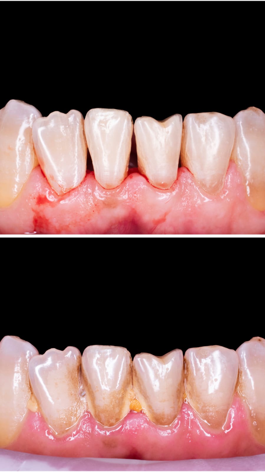 Dental Result 1