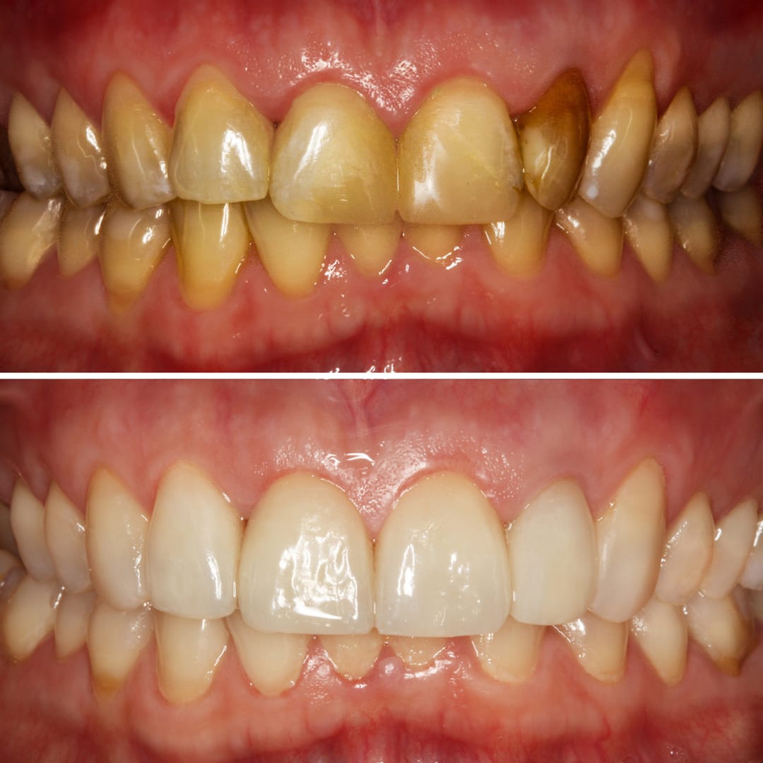 Dental Result 3
