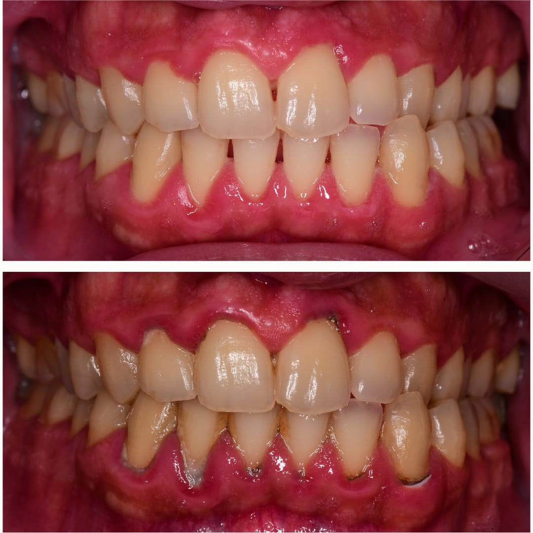 Dental Result 2