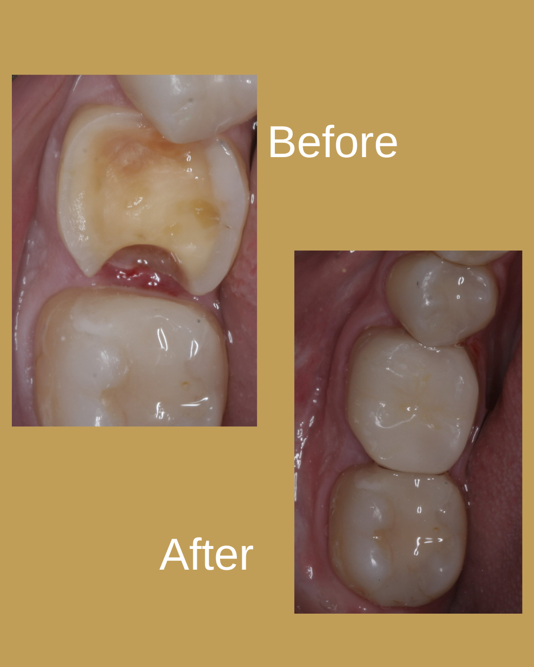 Dental Result 6